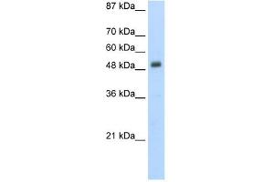 Desmin antibody used at 5 ug/ml to detect target protein. (Desmin Antikörper  (N-Term))