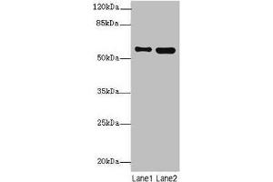 Western blot All lanes: STAM2 antibody at 4. (STAM2 Antikörper  (AA 376-525))
