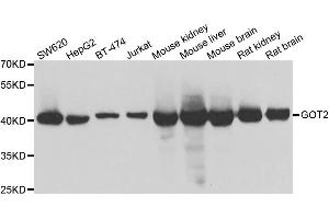 Western blot analysis of extracts of various cell lines, using GOT2 antibody. (GOT2 Antikörper)