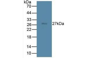 Detection of TMEM27 in Rat Spleen Tissue using Monoclonal Antibody to Transmembrane Protein 27 (TMEM27) (TMEM27 Antikörper  (AA 12-222))