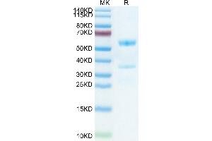 Mouse MFAP5 on Tris-Bis PAGE under reduced condition. (MFAP5 Protein (AA 29-164) (Fc Tag))