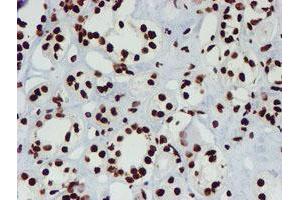 Immunohistochemical staining of paraffin-embedded Human Kidney tissue using anti-NONO mouse monoclonal antibody. (NONO Antikörper  (AA 184-385))
