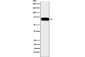 Western blot analysis of Poliovirus Receptor expression in U87-MG cell lysate. (Rekombinanter Poliovirus Receptor Antikörper)