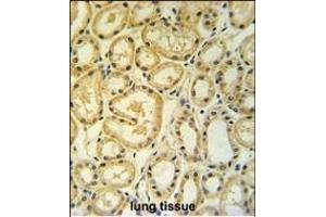 RT25 Antibody (C-term) (ABIN653808 and ABIN2843083) IHC analysis in formalin fixed and paraffin embedded human lung tissue followed by peroxidase conjugation of the secondary antibody and DAB staining. (MRPS25 Antikörper  (C-Term))