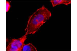 Western blot analysis using EDG6 (S1P4) monoclonal antibody (X1533M) on cell lysate transfected with EDG6 (S1P4) protein  at 5 µg/ml. (S1PR4 Antikörper  (C-Term))