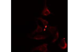 ABIN6274804 staining Hela cells by IF/ICC. (ACOT1 Antikörper  (Internal Region))