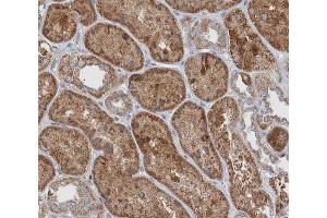 ABIN6266504 at 1/200 staining human kidney tissue sections by IHC-P. (JUP Antikörper  (C-Term))