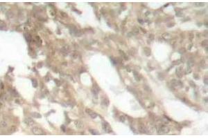 Immunohistochemistry (IHC) analyzes of PKC theta antibody in paraffin-embedded human skeletal muscle tissue. (PKC theta Antikörper)