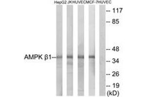 Western blot analysis of extracts from HepG2/Jurkat/HuvEc/MCF-7 cells, using AMPK beta1 (Ab-181) Antibody. (PRKAB1 Antikörper  (AA 147-196))