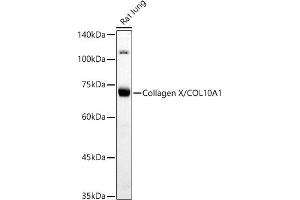 Western blot analysis of extracts of Rat lung, using Collagen X/COL10 antibody (8604) at 1:500 dilution.