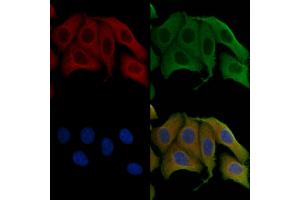 ABIN6256939 and ABIN6275335 staining Hela cells by IF/ICC.