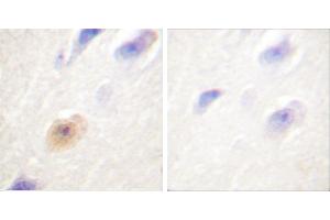 Peptide - +Immunohistochemical analysis of paraffin-embedded human brain tissue using CSantibody.