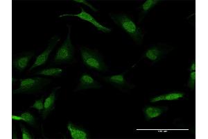 Immunofluorescence of purified MaxPab antibody to PPM1A on HeLa cell. (PPM1A Antikörper  (AA 1-382))