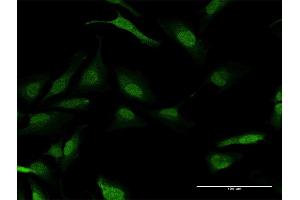 Immunofluorescence (IF) image for anti-Protein Phosphatase, Mg2+/Mn2+ Dependent, 1A (PPM1A) (AA 1-382) antibody (ABIN948299)