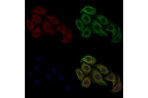 ABIN6260004 and ABIN6268779 staining Hela cells by IF/ICC. (Aquaporin 1 Antikörper  (Internal Region))