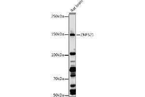 Western blot analysis of extracts of Rat brain, using ZNF521 antibody (ABIN7271496) at 1:1000 dilution. (ZNF521 Antikörper  (AA 210-420))