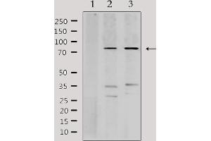 Western blot analysis of lysates from various samples, using K6PP Antibody.