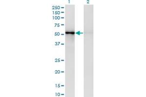 Western Blot analysis of ZNF207 expression in transfected 293T cell line by ZNF207 monoclonal antibody (M03), clone 6H8. (ZNF207 Antikörper  (AA 1-110))