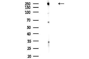Western blot analysis of lysates from HepG2 cells(LPS,4h treatment), using CABIN1 Antibody at 1/1000 dilution.