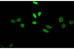 Immunofluorescence staining of HepG2 Cells with ABIN7127811 at 1:50, counter-stained with DAPI. (Rekombinanter SKP2 Antikörper)