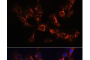Immunofluorescence analysis of C6 cells using ARL13B Polyclonal Antibody at dilution of 1:100. (ARL13B Antikörper)
