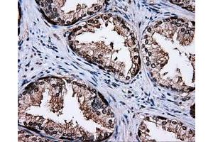 Immunohistochemical staining of paraffin-embedded liver tissue using anti-MCL1 mouse monoclonal antibody. (MCL-1 Antikörper)