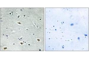 Immunohistochemistry analysis of paraffin-embedded human brain tissue, using MTG16 Antibody.