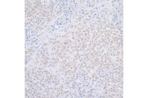 Immunohistochemistry (IHC) image for anti-ElaC Homolog 2 (ELAC2) (AA 776-826) antibody (ABIN7455054) (ELAC2 Antikörper  (AA 776-826))