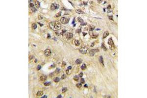 Image no. 2 for anti-Myc Proto-Oncogene protein (MYC) antibody (ABIN357365) (c-MYC Antikörper)