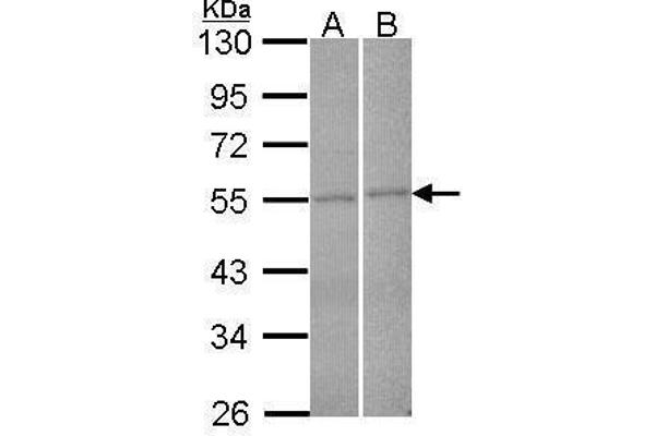 FBXL2 Antikörper  (N-Term)