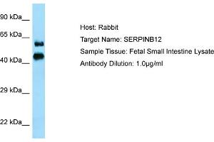 Host: RabbitTarget Name: SERPINB12Antibody Dilution: 1. (SERPINB12 Antikörper  (N-Term))