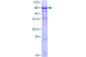 HABP2 Protein (AA 1-560) (GST tag)