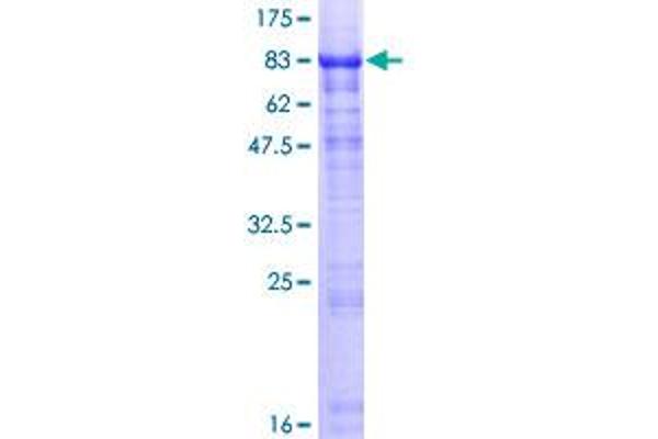 HABP2 Protein (AA 1-560) (GST tag)