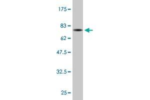 Western Blot detection against Immunogen (74. (SQSTM1 Antikörper  (AA 1-440))