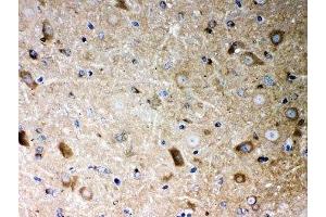 IHC-P: PP2A antibody testing of mouse brain tissue