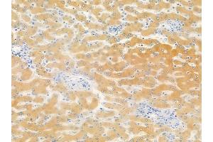 anti-tRNA Methyltransferase 11 Homolog (Trmt11) (C-Term) antibody
