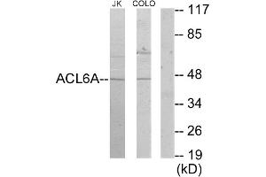 Western blot analysis of extracts from Jurkat cells and COLO205 cells, using ACL6A antibody.