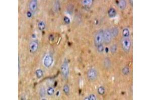 Used in DAB staining on fromalin fixed paraffin-embedded Brain tissue (HSPA4 Antikörper  (AA 258-511))