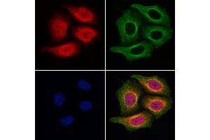 ABIN6257303 and ABIN6275012 staining Hela cells by IF/ICC. (KIF4A Antikörper  (C-Term))
