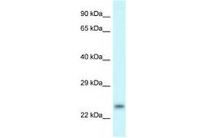 Image no. 1 for anti-rho Family GTPase 1 (RND1) (C-Term) antibody (ABIN6747628) (RND1 Antikörper  (C-Term))