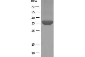 Western Blotting (WB) image for Coagulation Factor XI (F11) (AA 19-387) protein (His tag) (ABIN7122871)