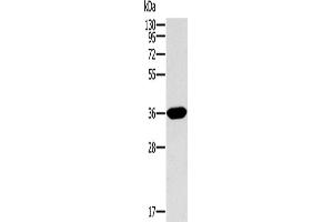 Western Blotting (WB) image for anti-Intelectin 1 (Galactofuranose Binding) (ITLN1) antibody (ABIN2430327)
