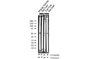 Western Blotting (WB) image for anti-Hepatocyte Nuclear Factor 4, alpha (HNF4A) (pSer313) antibody (ABIN6256265)