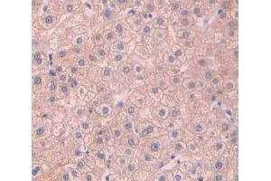IHC-P analysis of liver tissue, with DAB staining. (Asialoglycoprotein Receptor 2 Antikörper  (AA 1-311))