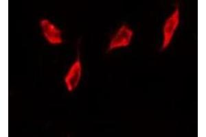 Immunofluorescence (fixed cells) (IF/ICC) image for anti-Baculoviral IAP Repeat-Containing 5 (BIRC5) (pThr117) antibody (ABIN6255588)