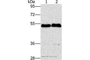 Western blot analysis of Mouse brain and liver tissue, using SPHK2 Polyclonal Antibody at dilution of 1:200 (SPHK2 Antikörper)