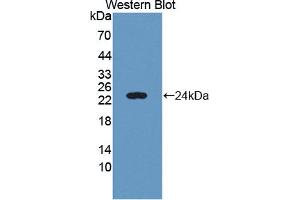 Western blot analysis of the recombinant protein. (C6orf150 Antikörper  (AA 225-407))