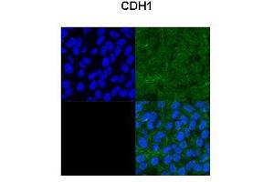 Immunofluorescence (IF) image for anti-Cadherin 1, Type 1, E-Cadherin (Epithelial) (CDH1) (Middle Region) antibody (ABIN2784498)