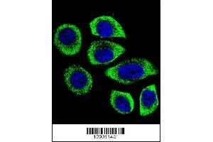 Confocal immunofluorescent analysis of PIP5KL1 Antibody with U-251MG cell followed by Alexa Fluor 488-conjugated goat anti-rabbit lgG (green). (PIP5KL1 Antikörper  (N-Term))