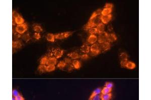 Immunofluorescence analysis of A431 cells using LAMC2 Polyclonal Antibody at dilution of 1:100 (40x lens). (LAMC2 Antikörper)
